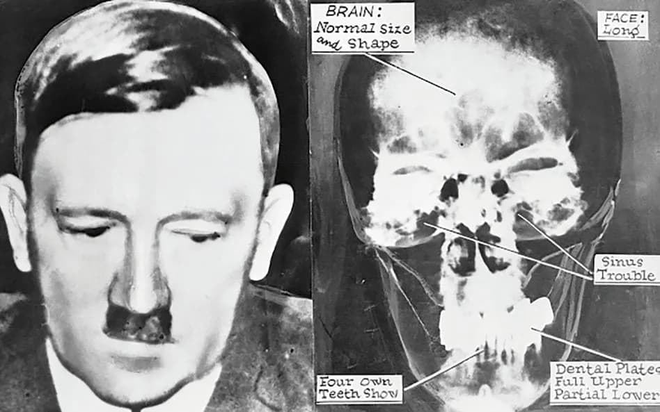 Kiedy zmarł Hitler? Zaskakujące okoliczności jego śmierci